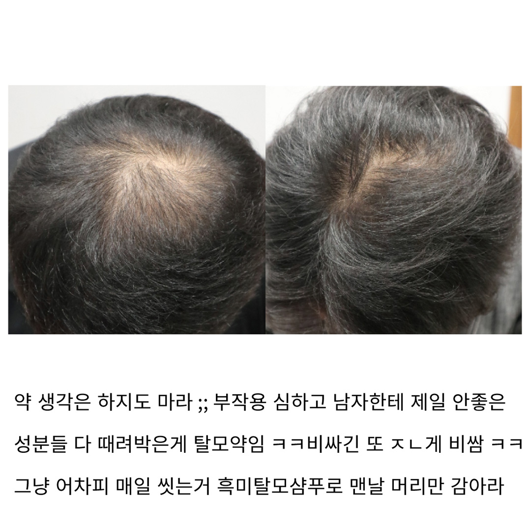 소개팅 비호감 1위 음... 너?