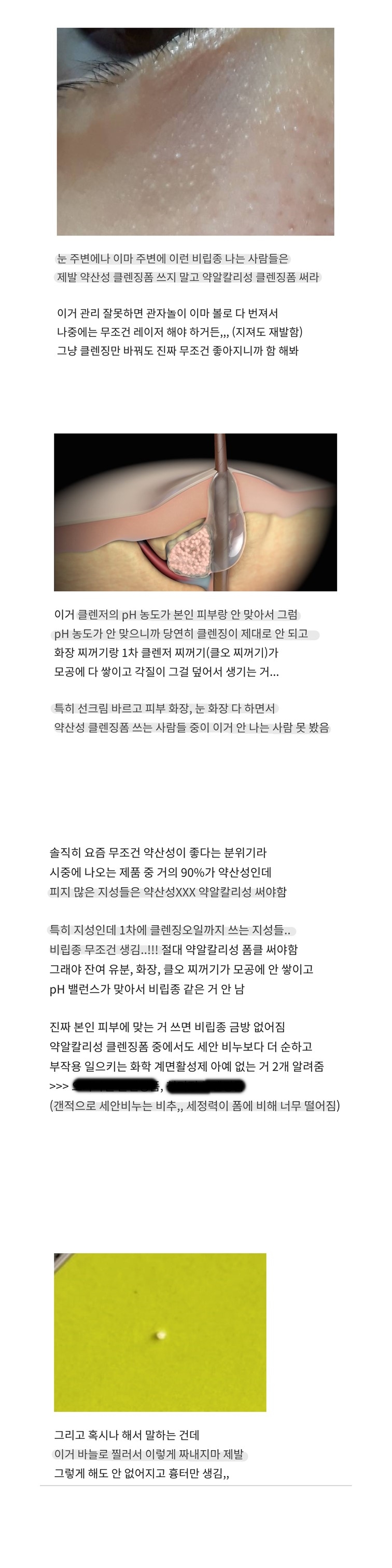 눈밑에 오돌토돌하게 생기는사람??