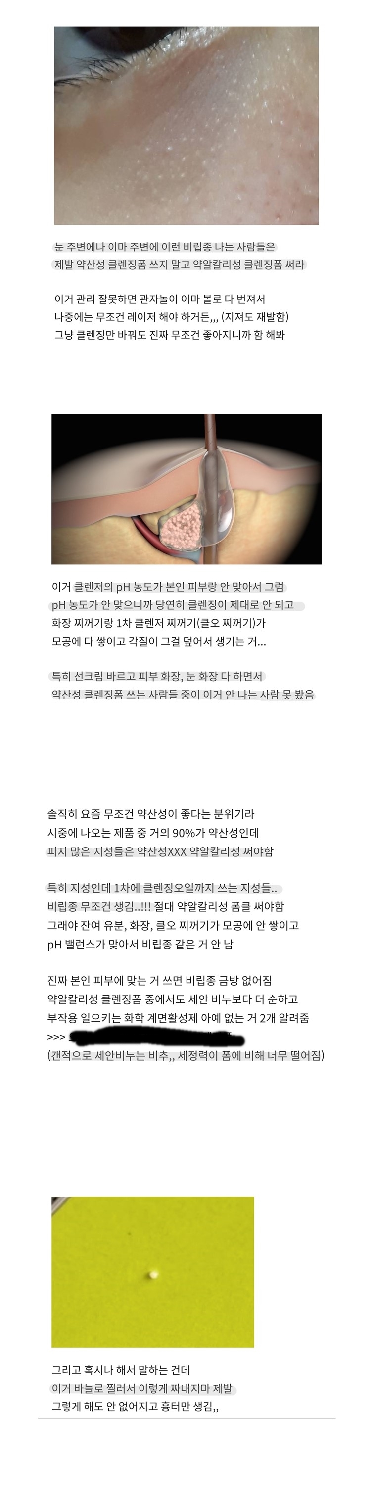 눈밑에 오돌토돌하게 생기는사람??