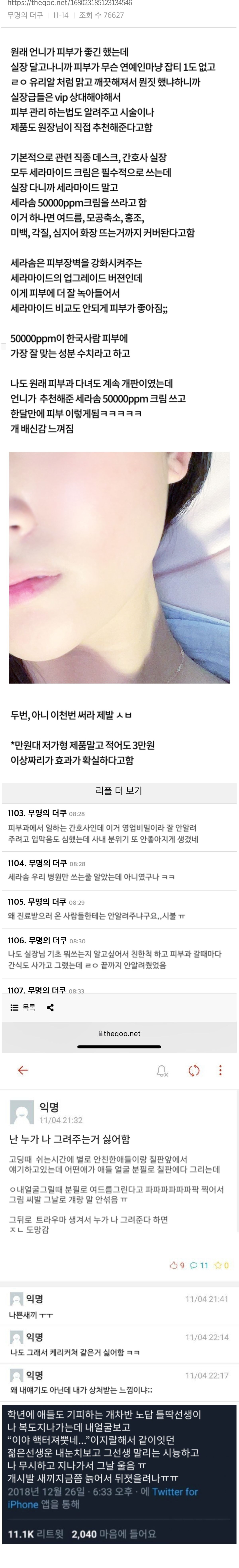 여드름이 일깨워준 추악한 기억