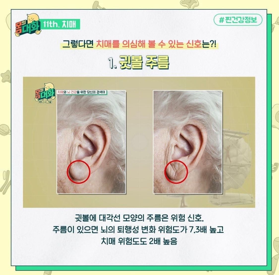 알고보면 치매를 부르는 습관