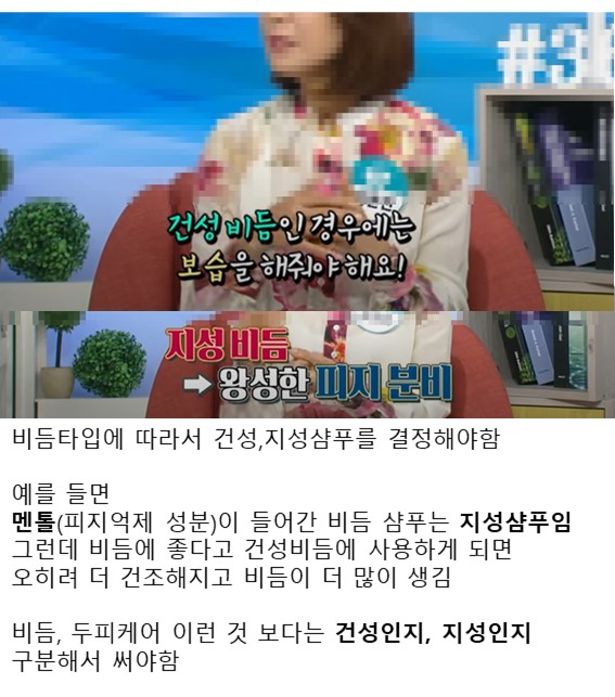 펌) 비듬샴푸 효과 1도 없음