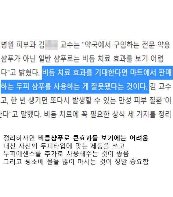 펌) 비듬샴푸 효과 1도 없음
