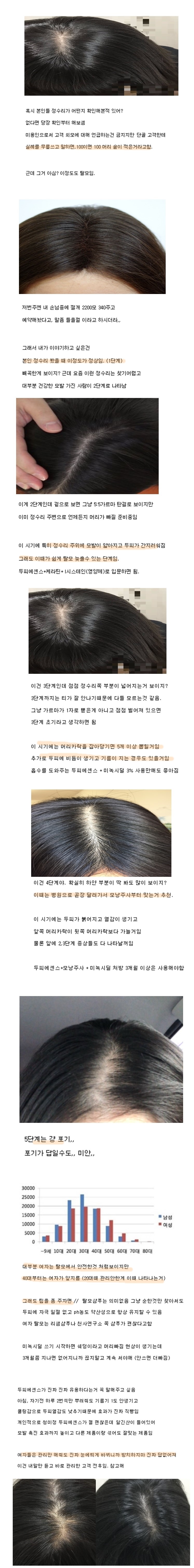 여자들 탈모 5단계 변화 ㄷㄷ