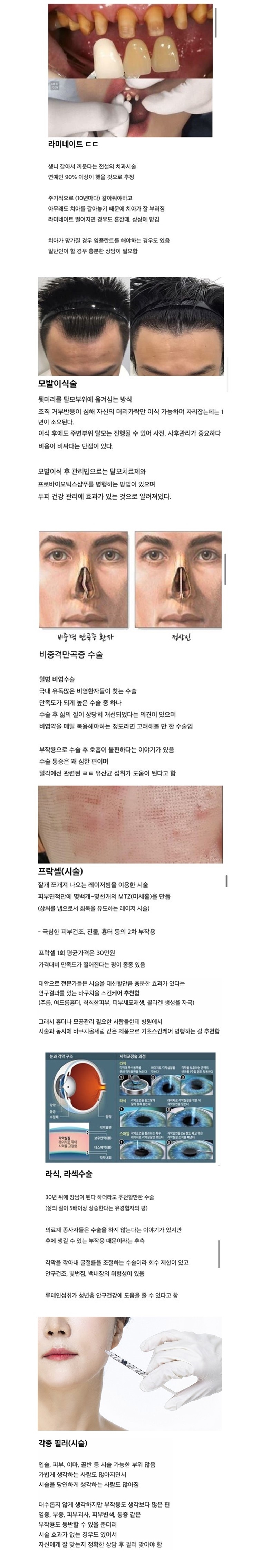 한국인 90%가 최소 한번은 고려해본 수술의현실