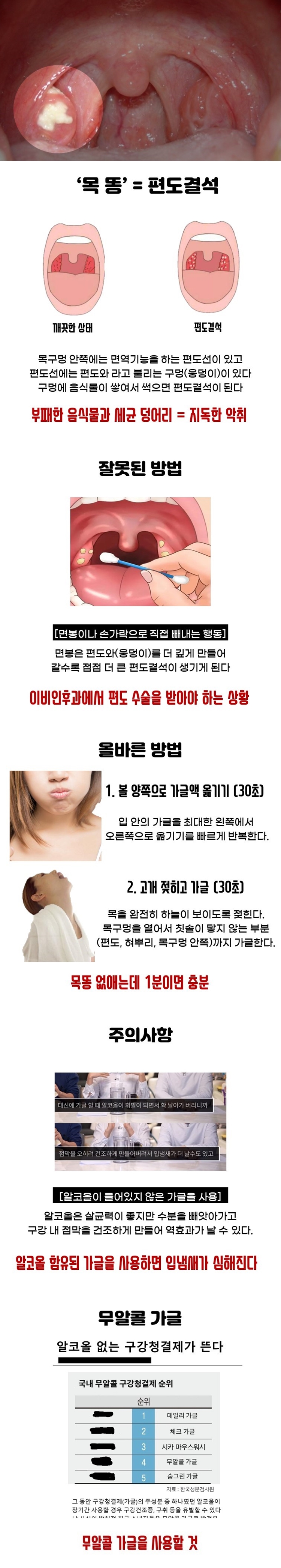지독한 냄새나는 목똥 없애는 법