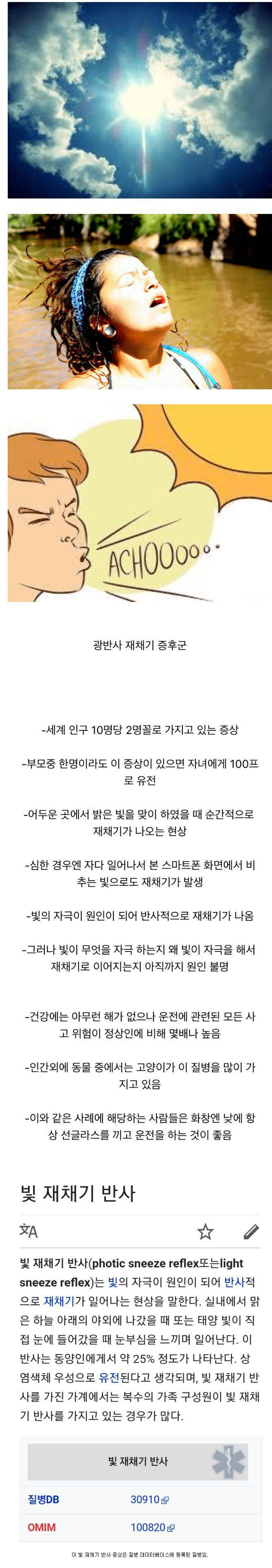 동양인 25%가 가지고있는 증상.jpg