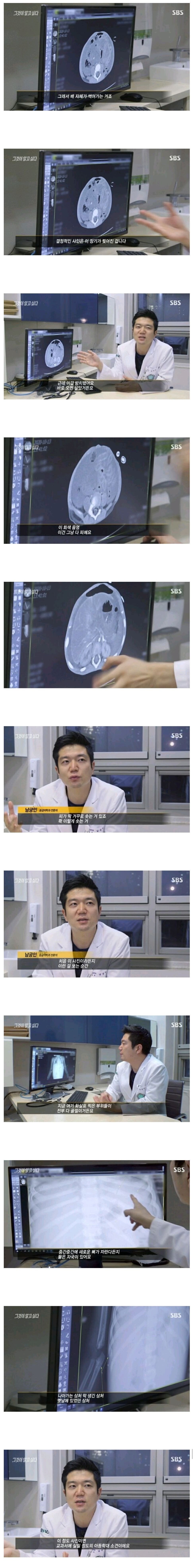 [ㅅㅂ] 정인이 사망하기 하루 전 모습+의사소견