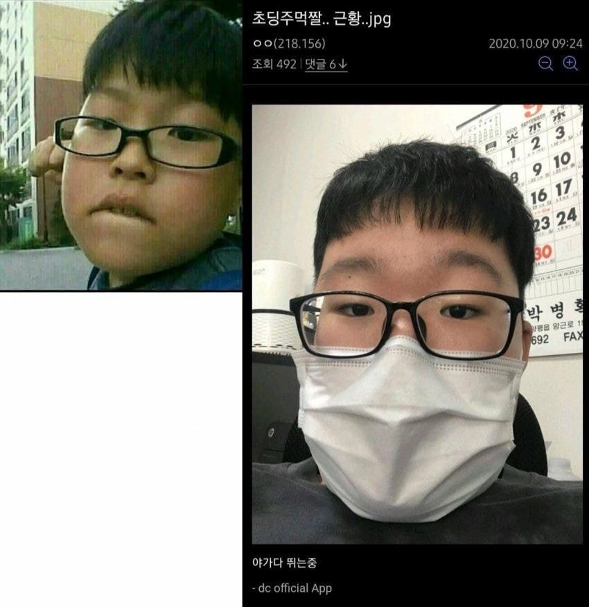 초딩 주먹짤 근황