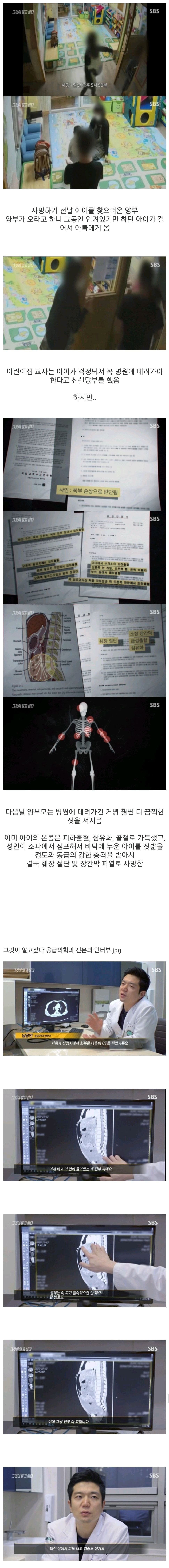 [ㅅㅂ] 정인이 사망하기 하루 전 모습+의사소견