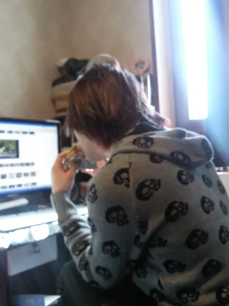 이홍기, 라식수술 후 모습 공개 